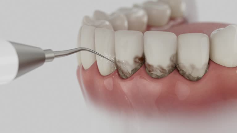 Reliable Tooth Extraction contractor in Hicksville, OH by Smile Center Dentistry